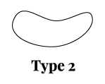 Typ 2