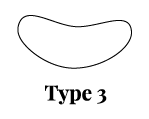 Typ 3