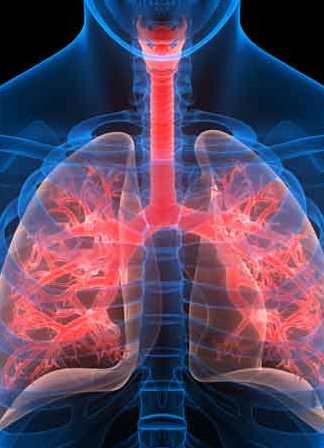 Zatorowość płucna